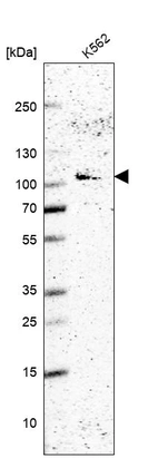 Western blot analysis in human cell line K562.