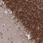 Immunohistochemical staining of human cerebellum shows strong nuclear positivity in cells in granular layer and Purkinje cells.