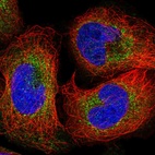 Immunofluorescent staining of human cell line U-2 OS shows localization to cytosol.