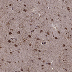 Immunohistochemical staining of human cerebral cortex shows strong nuclear positivity in neurons.