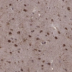 Immunohistochemical staining of human cerebral cortex shows strong nuclear positivity in neurons.