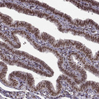 Immunohistochemical staining of human fallopian tube shows strong nuclear positivity in glandular cells.