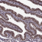 Immunohistochemical staining of human fallopian tube shows strong nuclear positivity in glandular cells.