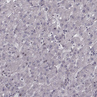 Immunohistochemical staining of human liver shows very weak nuclear positivity in hepatocytes.