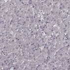 Immunohistochemical staining of human liver shows very weak nuclear positivity in hepatocytes.