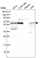 Western blot analysis in human cell line RT-4, human cell line U-251 MG, human plasma and human liver tissue.