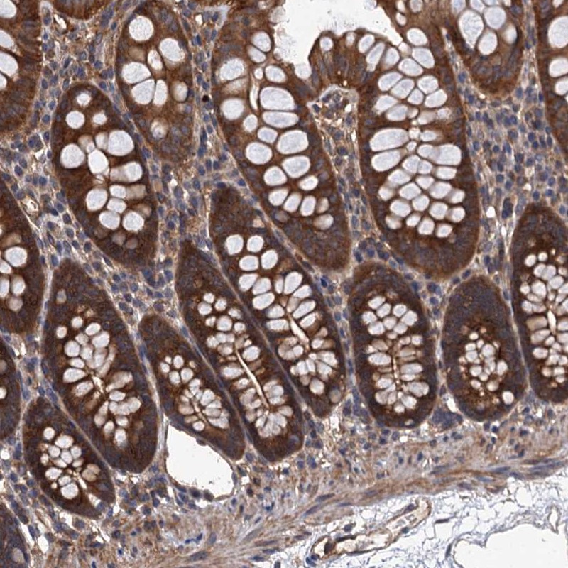 Anti-PPP4R1 Antibody