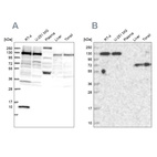 Western blot analysis using Anti-PPP4R1 antibody HPA041089 (A) shows similar pattern to independent antibody HPA040905 (B).