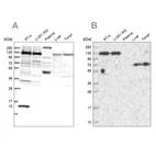 Western blot analysis using Anti-PPP4R1 antibody HPA041089 (A) shows similar pattern to independent antibody HPA040905 (B).