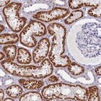 Immunohistochemical staining of human kidney shows strong granular cytoplasmic positivity in cells in tubules.