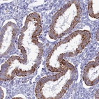 Immunohistochemical staining of human endometrium shows strong granular cytoplasmic positivity in glandular cells.