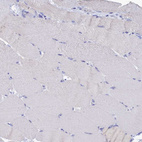 Immunohistochemical staining of human skeletal muscle shows no positivity in myocytes as expected.