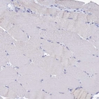 Immunohistochemical staining of human skeletal muscle shows no positivity in myocytes as expected.