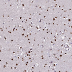Immunohistochemical staining of human cerebral cortex shows strong nuclear positivity in neurons.