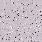 Immunohistochemical staining of human cerebral cortex shows strong nuclear positivity in neurons.