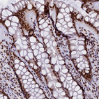 Immunohistochemical staining of human rectum shows strong nuclear positivity in glandular cells.