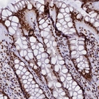 Immunohistochemical staining of human rectum shows strong nuclear positivity in glandular cells.