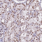 Anti-CPSF7 Antibody