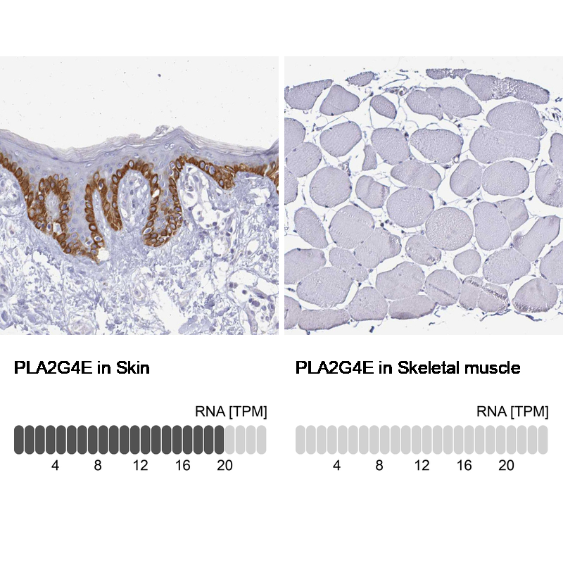 Anti-PLA2G4E Antibody