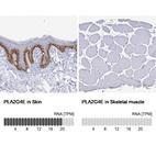 Anti-PLA2G4E Antibody