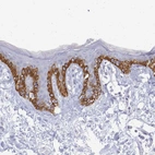 Immunohistochemical staining of human skin shows strong cytoplasmic positivity in basal squamous epithelial cells.