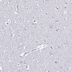 Anti-PLA2G4E Antibody