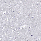 Immunohistochemical staining of human cerebral cortex shows no positivity in neurons as expected.