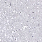 Immunohistochemical staining of human cerebral cortex shows no positivity in neurons as expected.