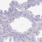 Immunohistochemical staining of human prostate shows no positivity in glandular cells as expected.