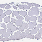 Anti-PLA2G4E Antibody