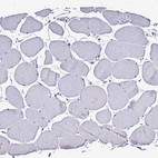 Immunohistochemical staining of human skeletal muscle shows no positivity in myocytes as expected.