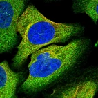 Immunofluorescent staining of human cell line U-2 OS shows localization to cytosol & microtubules.