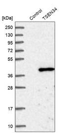 Western blot analysis in control (vector only transfected HEK293T lysate) and TSEN34 over-expression lysate (Co-expressed with a C-terminal myc-DDK tag (~3.1 kDa) in mammalian HEK293T cells, LY402979).