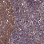 Anti-NME1 Antibody