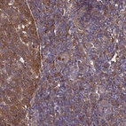 Anti-NME1 Antibody