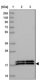 Lane 1: Marker [kDa] 250, 130, 95, 72, 55, 36, 28, 17, 10_br/_Lane 2: Human cell line RT-4_br/_Lane 3: Human cell line U-251MG sp