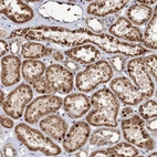 Anti-C16orf45 Antibody