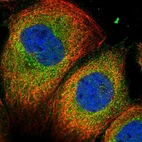 Immunofluorescent staining of human cell line A-431 shows localization to cytosol.