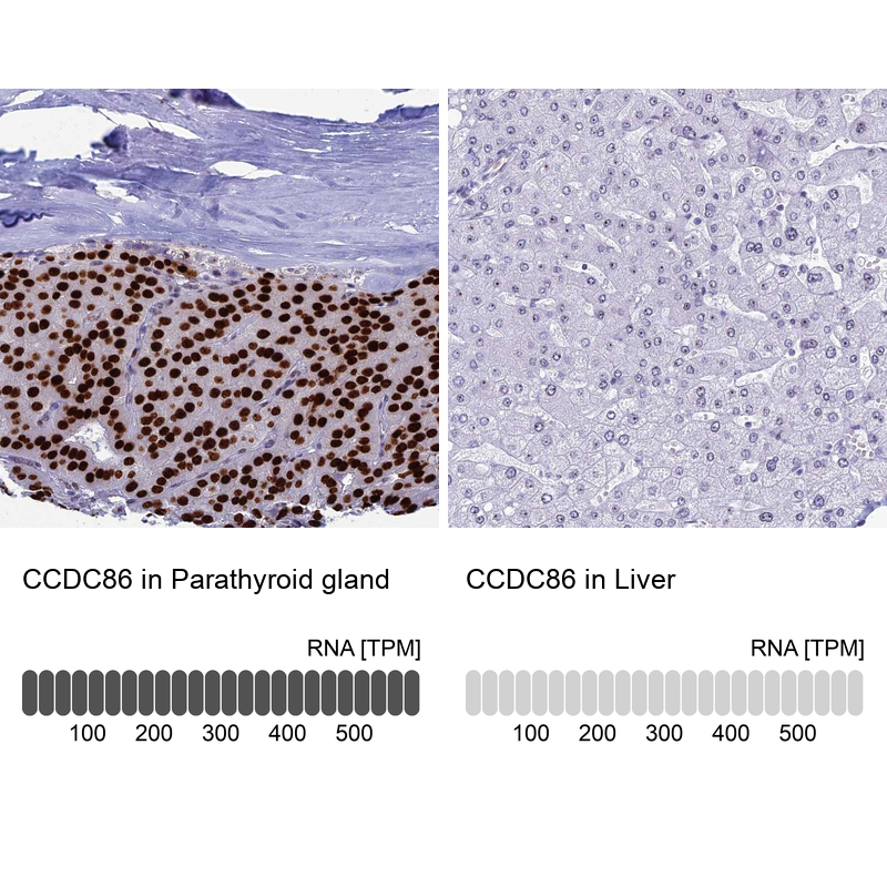 Anti-CCDC86 Antibody