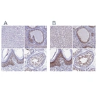 Immunohistochemical staining of human liver, prostate, squamous epithelia and testis using Anti-CCDC86 antibody HPA041117 (A) shows similar protein distribution across tissues to independent antibody HPA041540 (B).