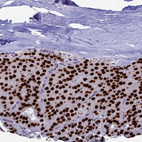 Immunohistochemical staining of human Parathyroid gland shows strong nuclear positivity in glandular cells.