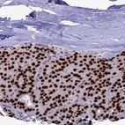 Immunohistochemical staining of human Parathyroid gland shows strong nuclear positivity in glandular cells.