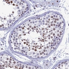 Immunohistochemical staining of human Testis shows moderate nuclear positivity in cells in seminiferous ducts and leydig cells.
