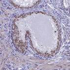 Immunohistochemical staining of human Prostate shows moderate nuclear positivity in glandular cells.