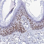 Immunohistochemical staining of human Skin shows moderate nuclear positivity in squamous epithelial cells.