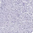 Immunohistochemical staining of human Liver shows very weak nuclear positivity in hepatocytes.