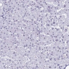 Immunohistochemical staining of human Liver shows very weak nuclear positivity in hepatocytes.