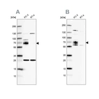 Western blot analysis using Anti-CCDC86 antibody HPA041117 (A) shows similar pattern to independent antibody HPA041540 (B).