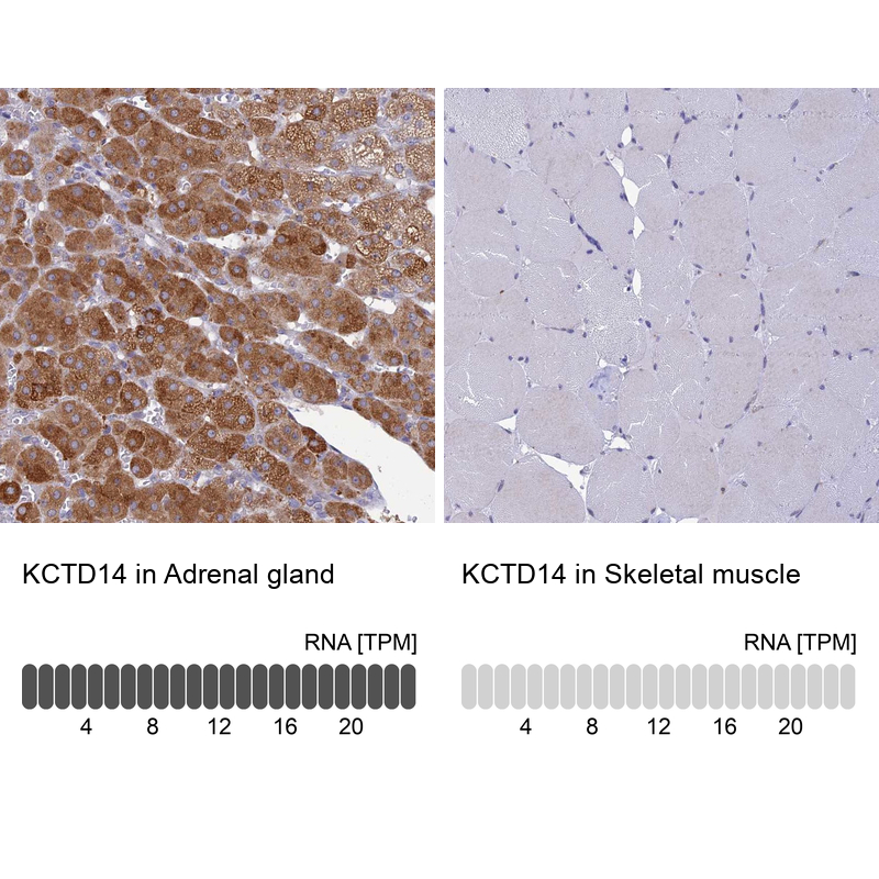 Anti-KCTD14 Antibody