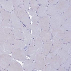 Immunohistochemical staining of human skeletal muscle shows low expression as expected.